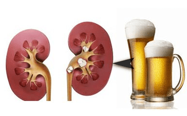 O efeito do álcool nos rins